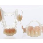 Ацеталовый зубной протез: плюсы и минусы выбора