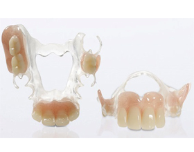 Ацеталовый зубной протез