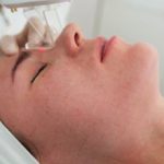 Лазерная шлифовка лица — плюсы и минусы процедуры