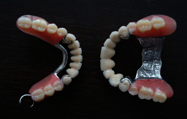 Новые бюгельные съемные зубные протезы