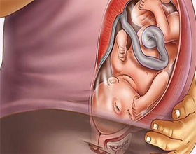 Если при родах порвалась шейка матки — возможные последствия