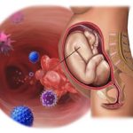 Цитомегаловирус при беременности — возможные последствия