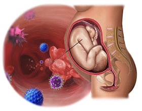 Цитомегаловирус при беременности — возможные последствия