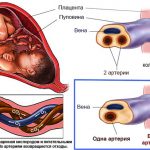 ЕАП при беременности: что это, причины и последствия