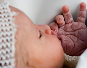 Последствия гипоксии у новорожденных