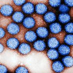 Возможные последствия ротавирусной инфекции