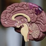 Последствия кровоизлияния в мозг