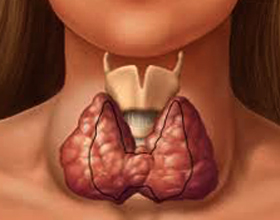 Увеличение щитовидной железы: причины и последствия