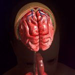 Арахноидит головного мозга: причины, симптомы и последствия