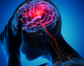 Причины и последствия атрофии мозжечка головного мозга