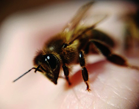 Возможные последствия после укуса пчелы