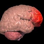 Контузия головного мозга — причины и последствия