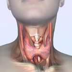 Главные последствия удаления щитовидной железы