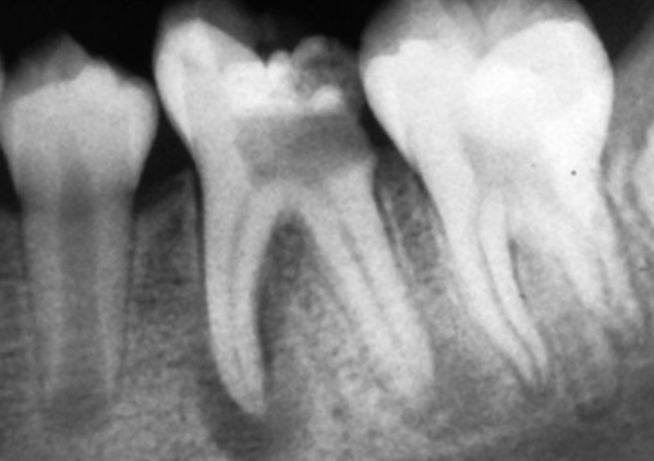 Снимок зубов