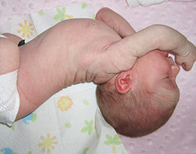 Судороги у новорожденного ребенка: причины и последствия