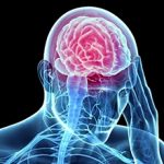 Какие могут быть последствия черепно-мозговой травмы для здоровья