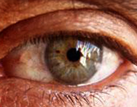 Тромбоз глаза, его причины последствия