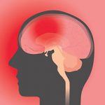 Последствия сотрясения мозга для организма человека